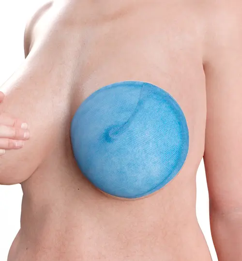 LIQUEEMAX® - Beispielanwendung: Brust (konvex)