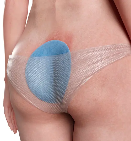 LIQUEEMAX® - Beispielanwendung: Sakral /Gluteal